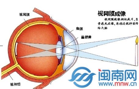 27歲網(wǎng)店店主每天上網(wǎng)超10小時 右眼突然失明