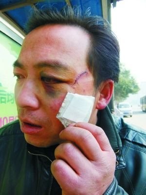 受傷村民。本報記者 張學(xué)江 王釗 攝