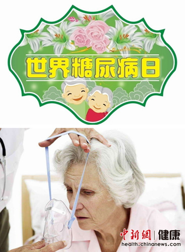 opַ׻D